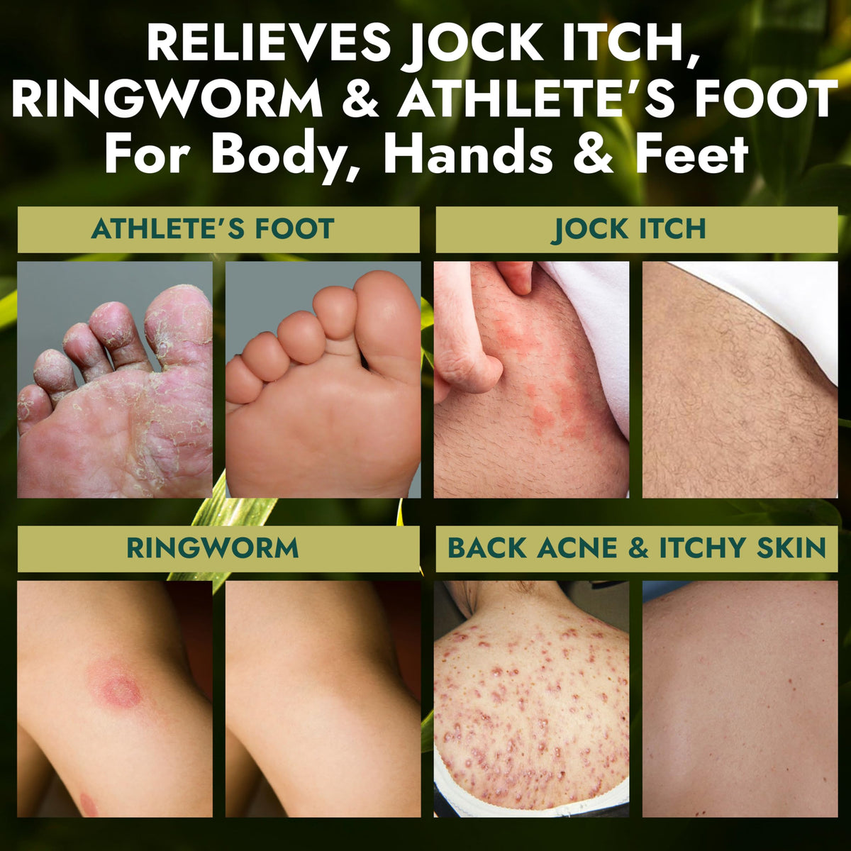 Terramed Just Think Comfort being applied to feet, shows targeted antifungal cleansing benefit