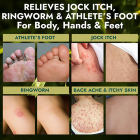 Terramed Just Think Comfort being applied to feet, shows targeted antifungal cleansing benefit