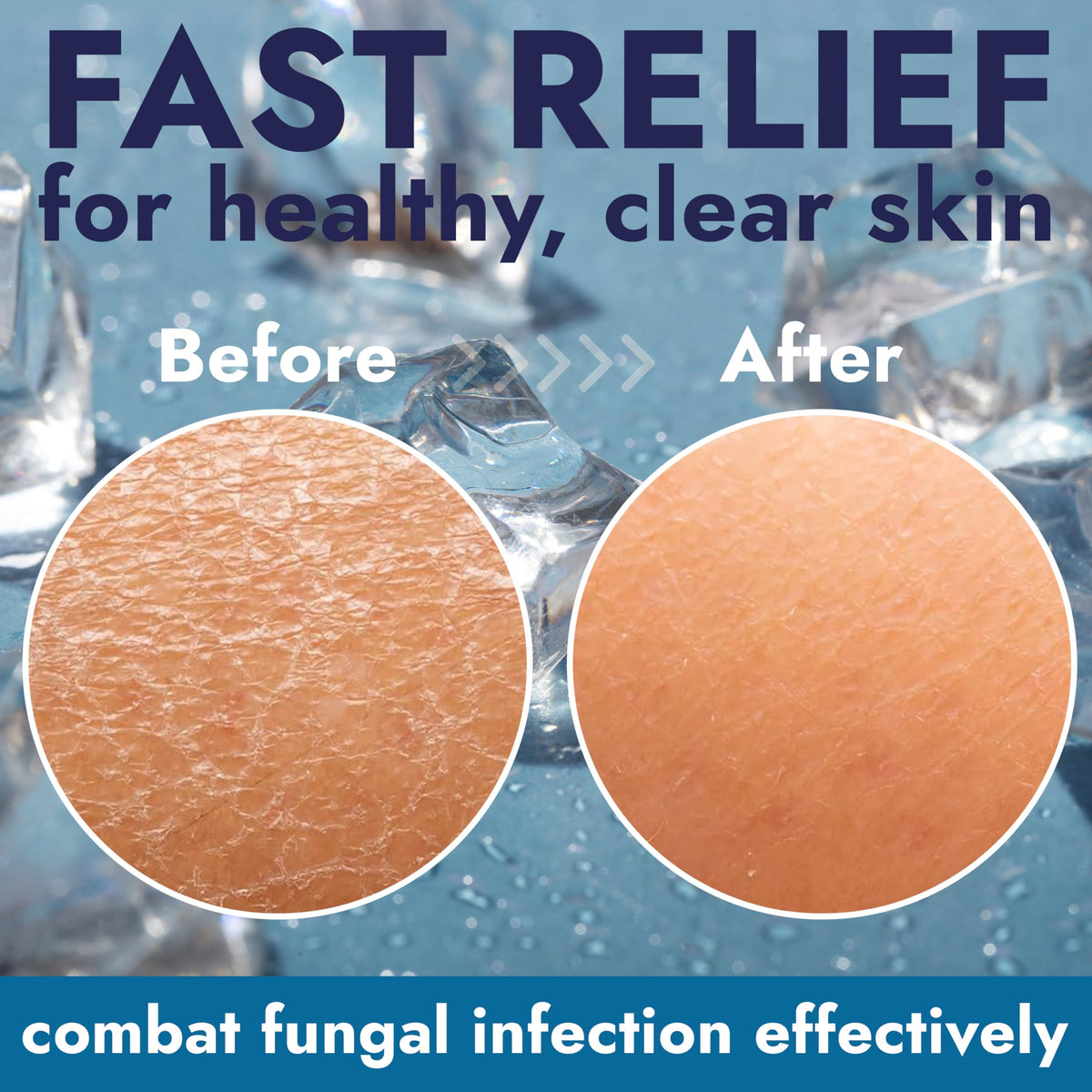 Terramed Just Think Comfort used on feet in a shower, demonstrating post-workout antifungal cleansing and cooling