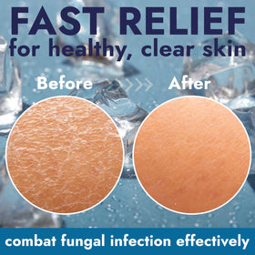 Terramed Just Think Comfort used on feet in a shower, demonstrating post-workout antifungal cleansing and cooling