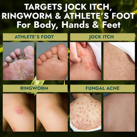 Terramed Just Think Comfort being lathered in shower for targeted antifungal wash