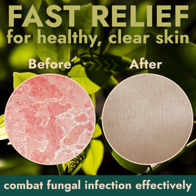 Terramed Just Think Comfort ingredient label photo emphasizing 1% tolnaftate and botanical additives for trust