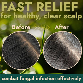 Terramed Just Think Comfort ingredients label close-up highlighting botanicals