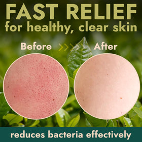 Terramed Just Think Comfort label closeup highlighting key ingredients for transparency benefit