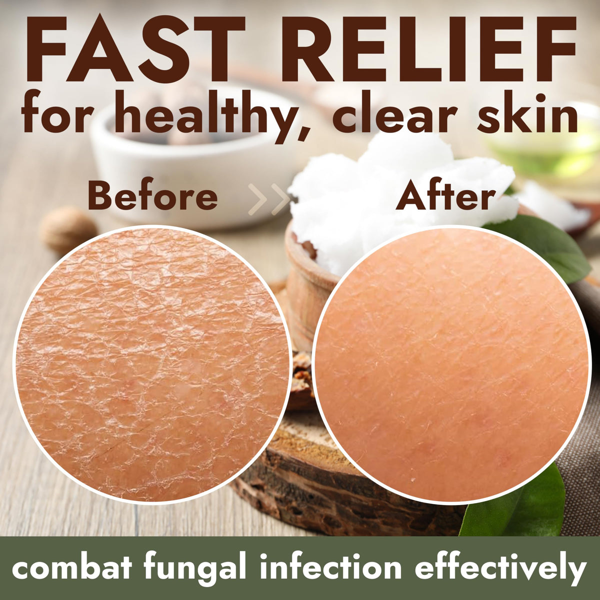Terramed Just Think Comfort soap inside protective case for hygienic travel storage