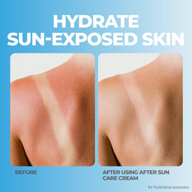 terrasil lotion application on arm illustrating quick absorption and relief