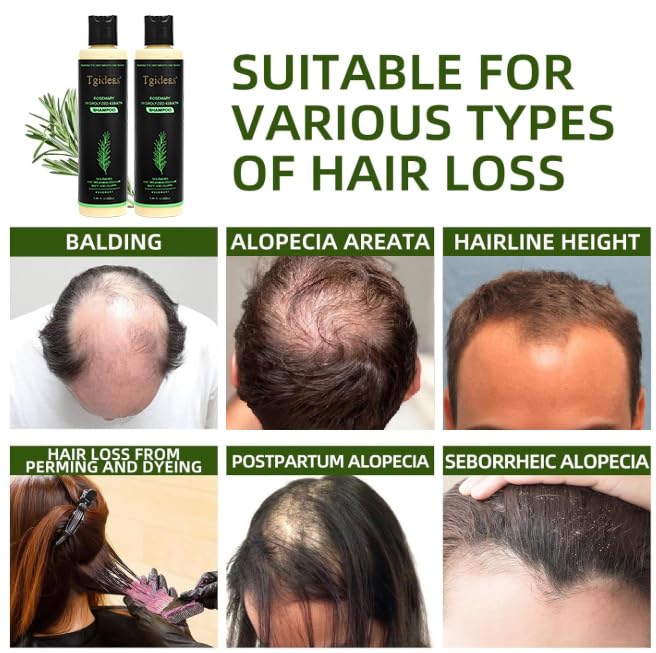 Tgideas shampoo in hand demonstrating control and gentle cleansing benefit