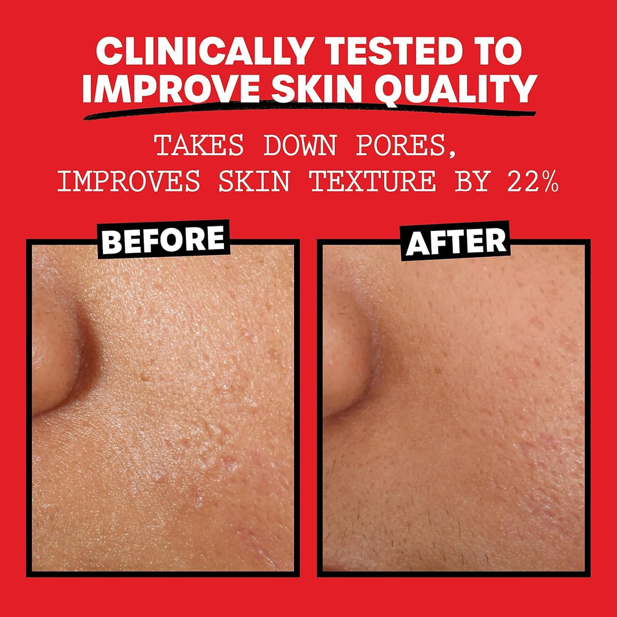 THAYERS toner applied with cotton pad demonstrating gentle prep for skincare