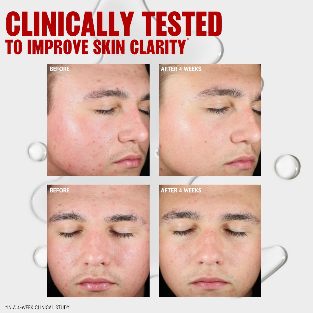 Thayers toner being applied to skin from hand, helps remove oil and impurities
