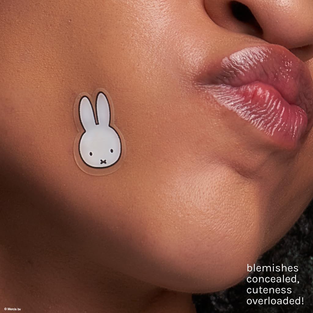 The Crème Shop patches applied on cheek demonstrating discreet coverage