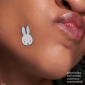 The Crème Shop patches applied on cheek demonstrating discreet coverage