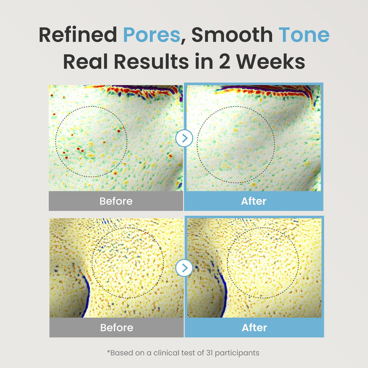 The Face Shop pipette dispensing serum for precise, hygienic application