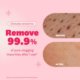 the face shop close-up texture of foaming cleanser for gentle hydration