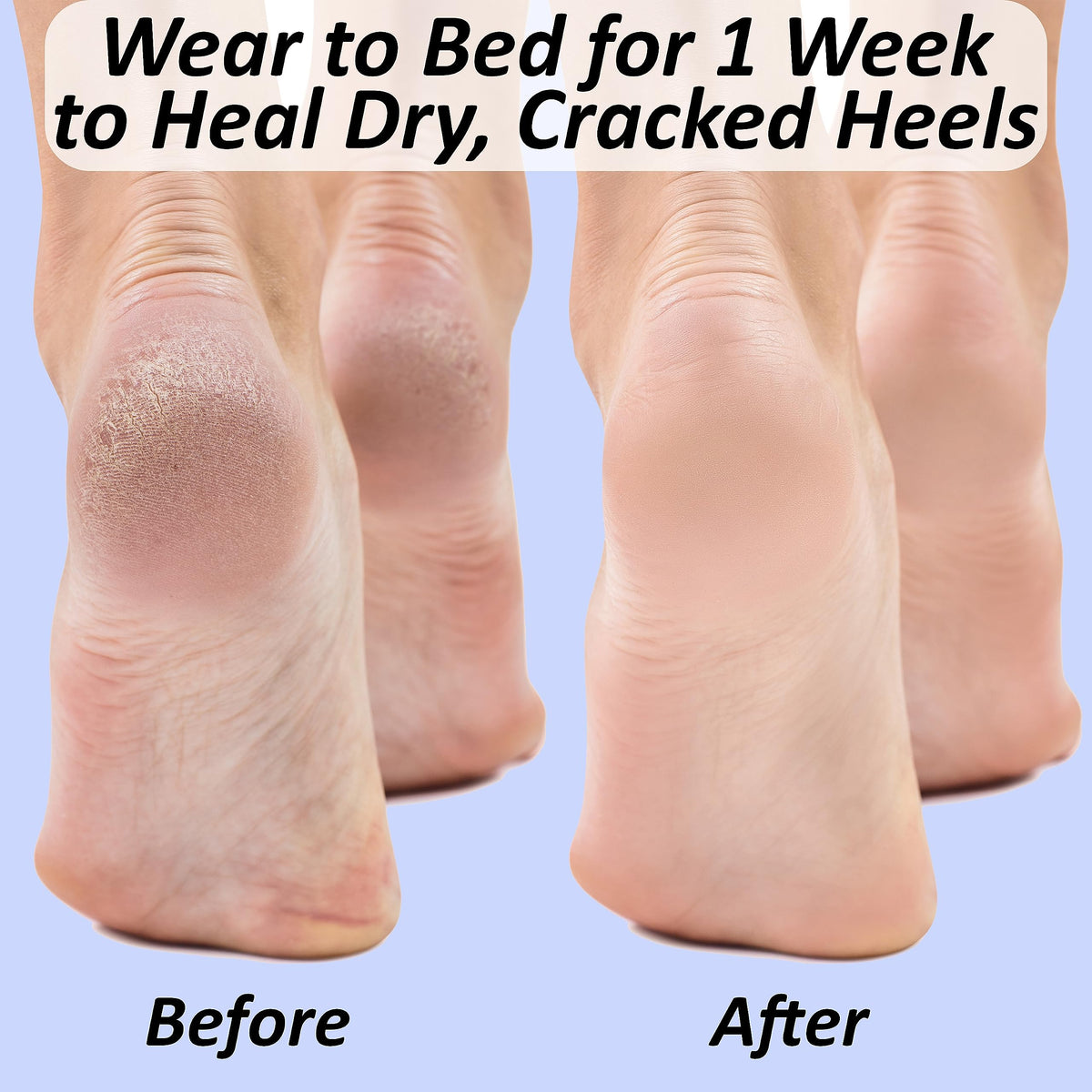 The Foot Medic size comparison with ruler showing one-size-fit-most