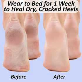 The Foot Medic size comparison with ruler showing one-size-fit-most