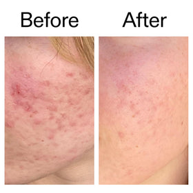 The INKEY List serum staged on bathroom shelf suggesting routine compatibility