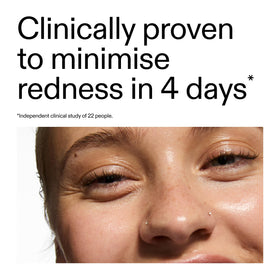 The INKEY List micro-fine green pigment close-up masking redness for even tone