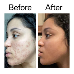 Before and after comparison demonstrating improved tone with The INKEY List treatment benefit