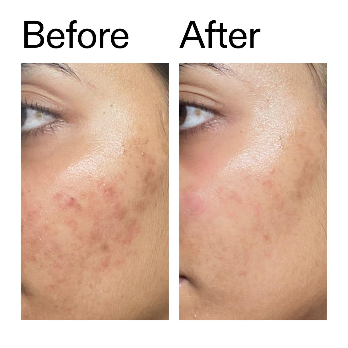 The INKEY List before and after texture comparison showing smoother skin