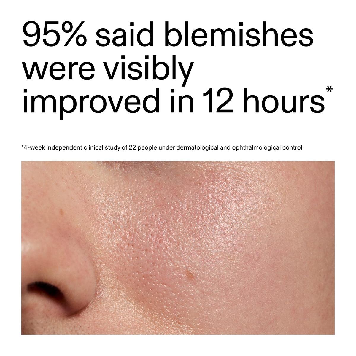 The INKEY List ingredient label detail highlighting succinic, sulfur and salicylic acids for informed users