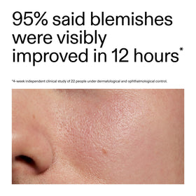 The INKEY List ingredient label detail highlighting succinic, sulfur and salicylic acids for informed users