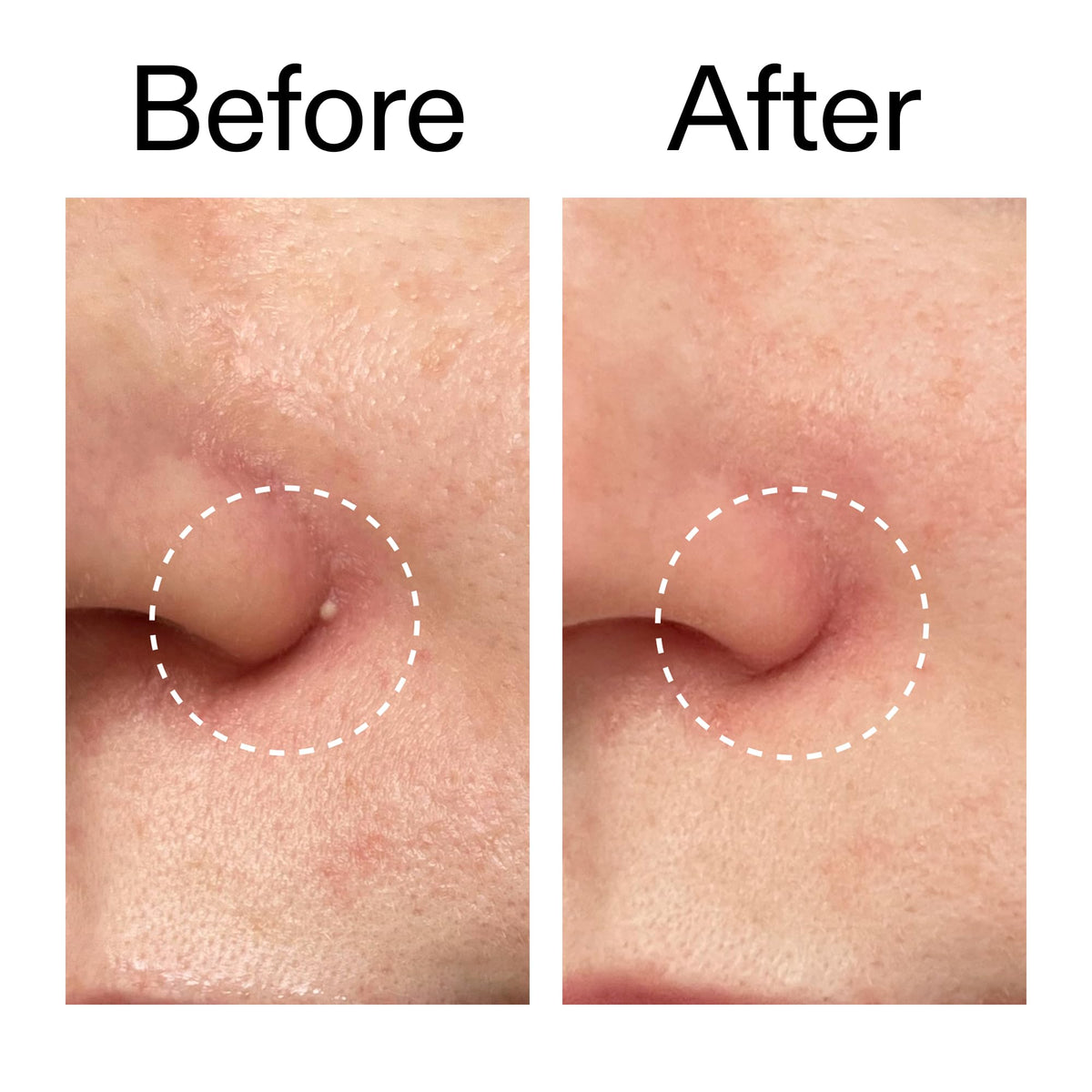 The INKEY List ingredient label highlighting salicylic acid benefit