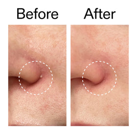 The INKEY List ingredient label highlighting salicylic acid benefit