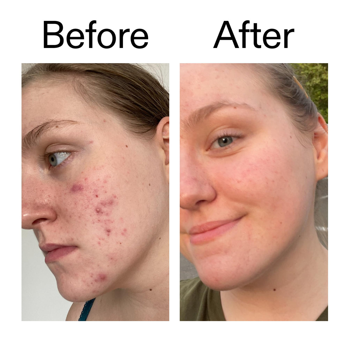 The INKEY List application on cotton pad demonstrating easy targeted exfoliation benefit