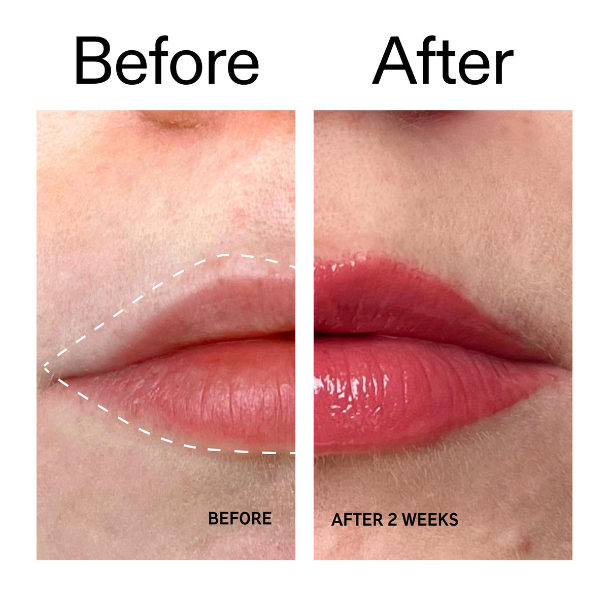 The INKEY List balm worn on lips in lifestyle shot showing natural fuller-looking benefit