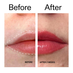 The INKEY List balm worn on lips in lifestyle shot showing natural fuller-looking benefit