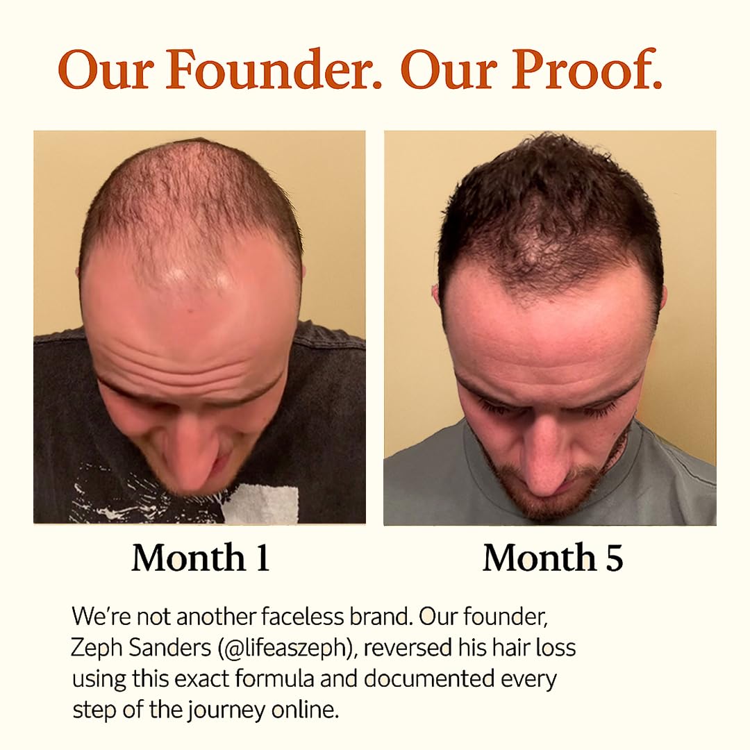 Applying The Mane Solution serum to scalp with parting showing focused nourishment and scalp comfort