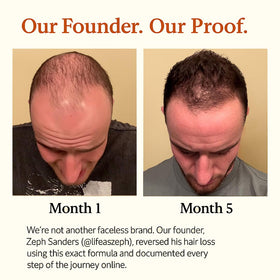 Applying The Mane Solution serum to scalp with parting showing focused nourishment and scalp comfort