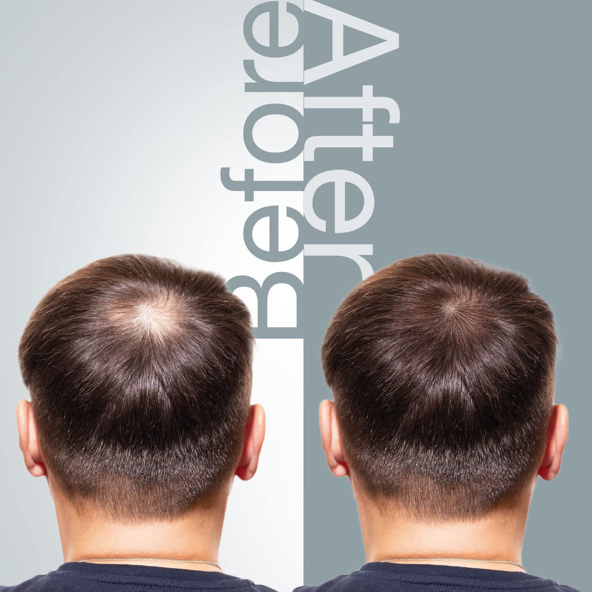 The Mossi London ingredient panel close-up highlighting biotin, Procapil and saw palmetto