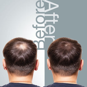 The Mossi London ingredient panel close-up highlighting biotin, Procapil and saw palmetto