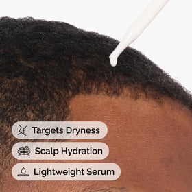 The Ordinary serum applied to fingertips demonstrating targeted scalp application and comfort benefit