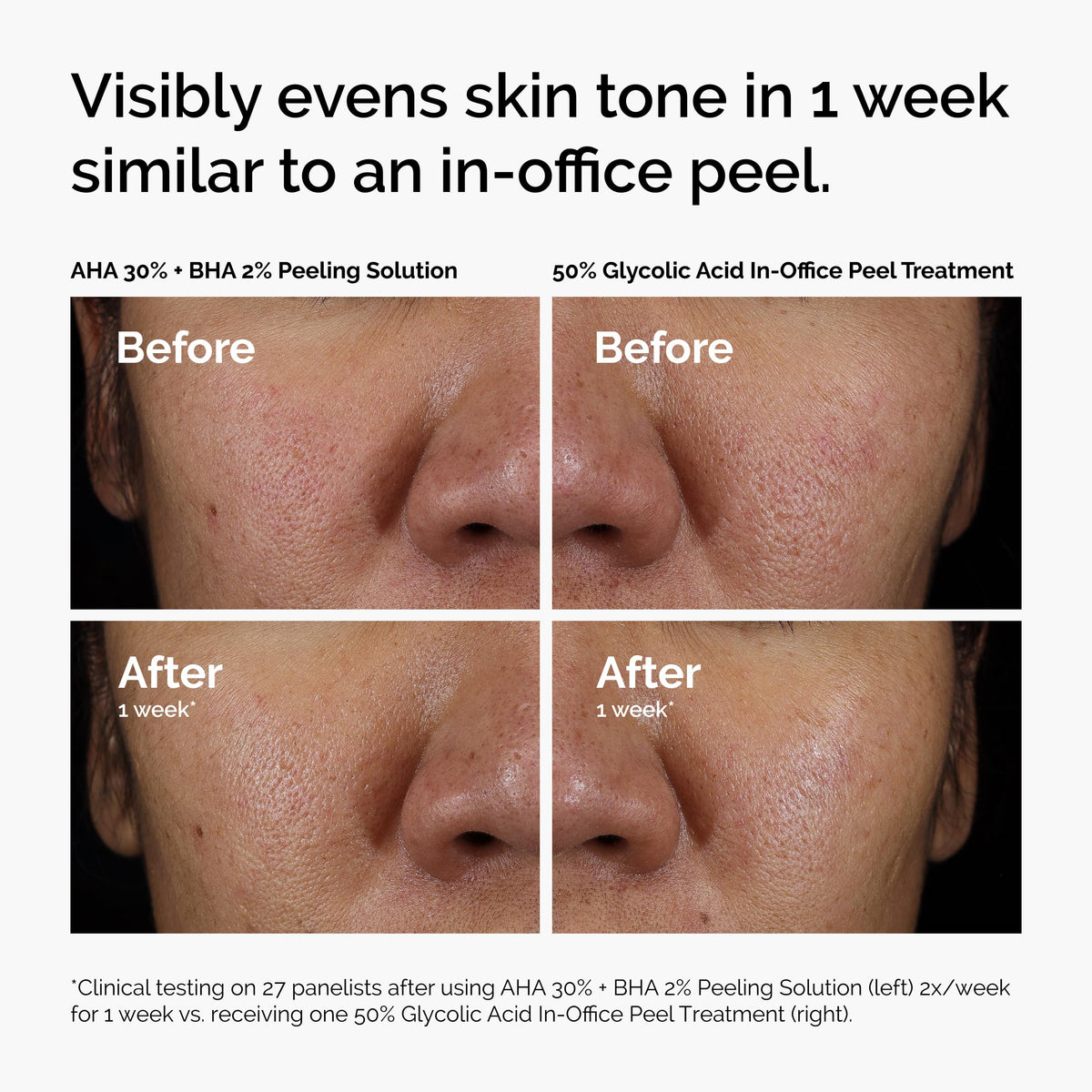 The Ordinary duo in a bathroom lifestyle scene showing routine placement and daily-use convenience benefit