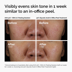 The Ordinary duo in a bathroom lifestyle scene showing routine placement and daily-use convenience benefit
