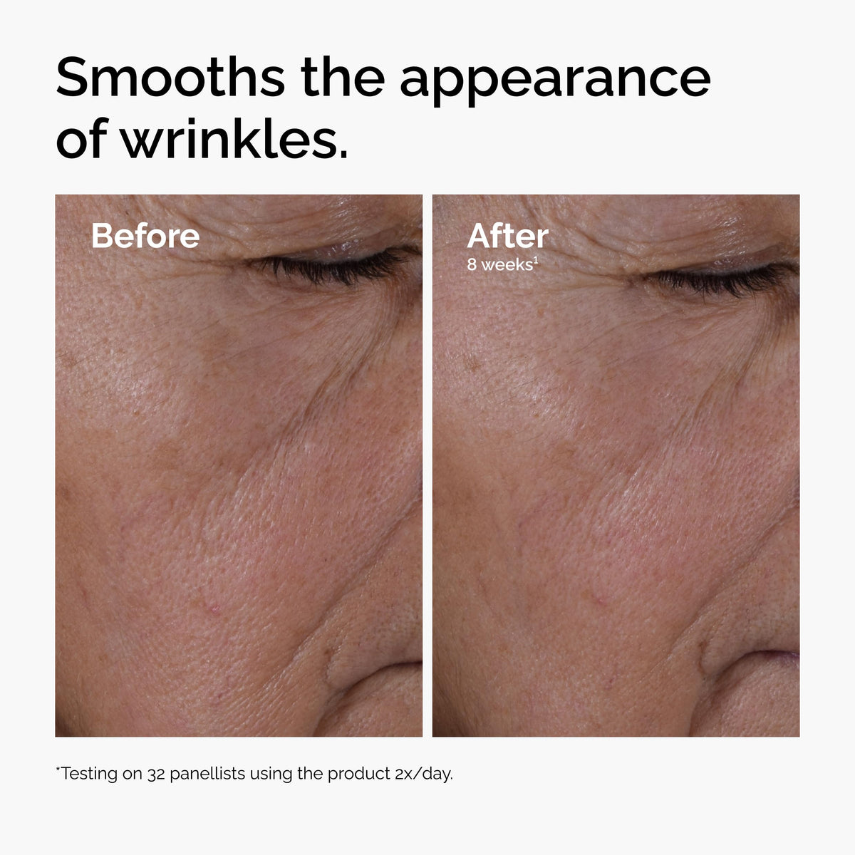The Ordinary serum on skin being applied to outer eye area to improve texture and hydration