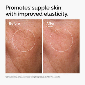 The Ordinary niacinamide bottle label detail showing pore-refining benefits