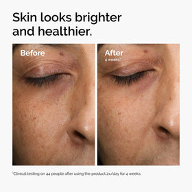 The Ordinary 1 fl oz bottle beside ruler showing compact travel-friendly size