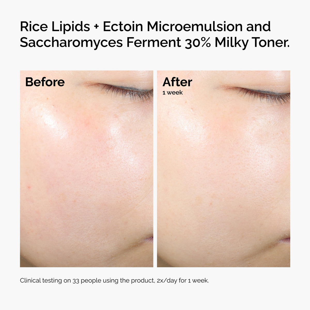 The Ordinary applying emulsion to cheek demonstrating instant absorption and visible soothing