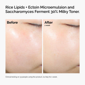 The Ordinary applying emulsion to cheek demonstrating instant absorption and visible soothing
