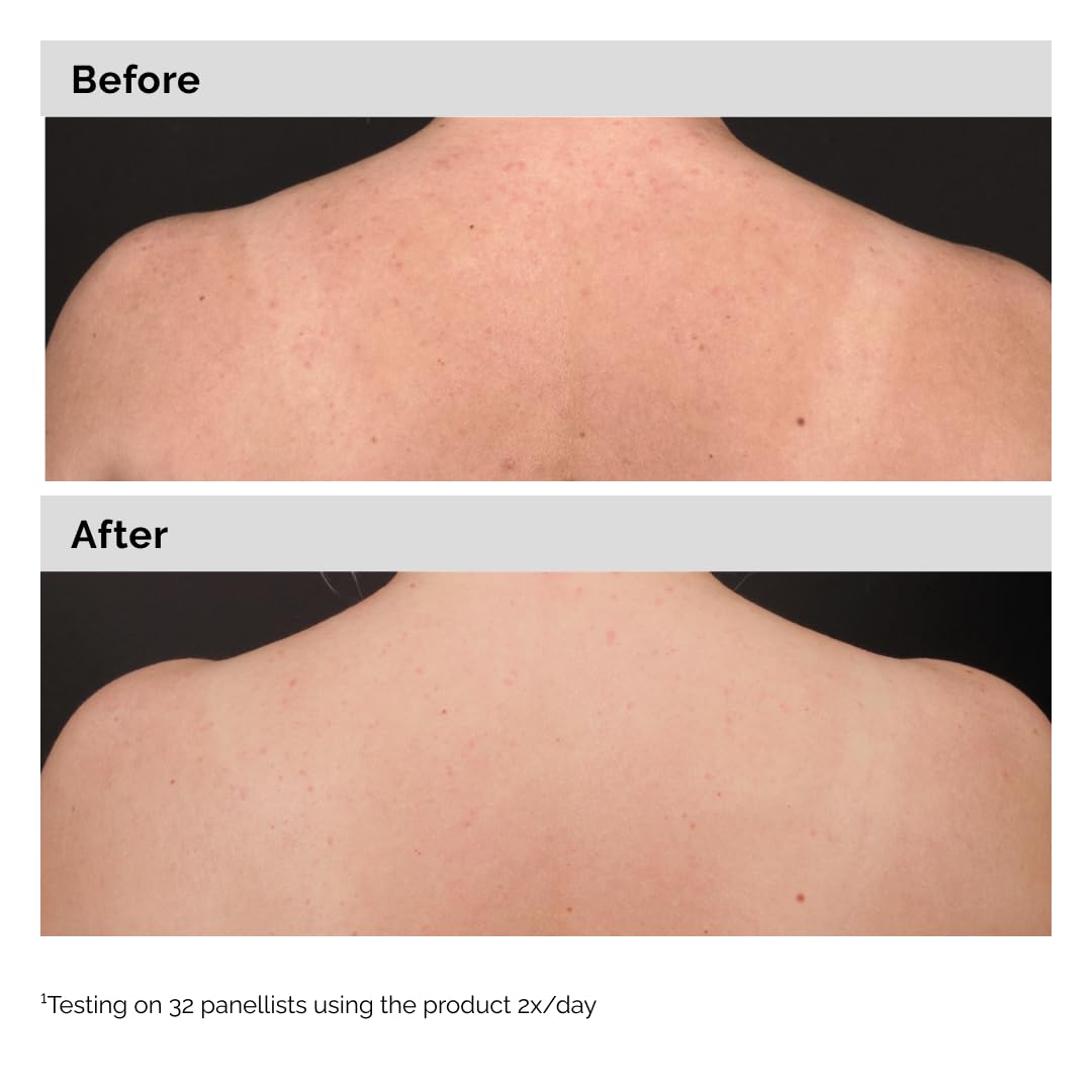 The Ordinary serum dispensed on hand illustrating ease of application and spreadability