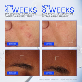 The Outset product label close-up highlighting key actives and benefits