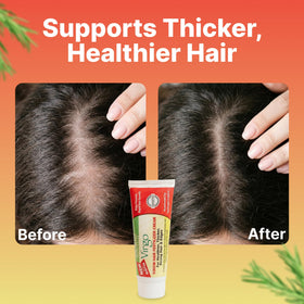 The Roots Naturelle applied to hairline showing gentle edge nourishment