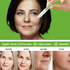 THESKCARE serum on skin demonstrating lightweight hydration