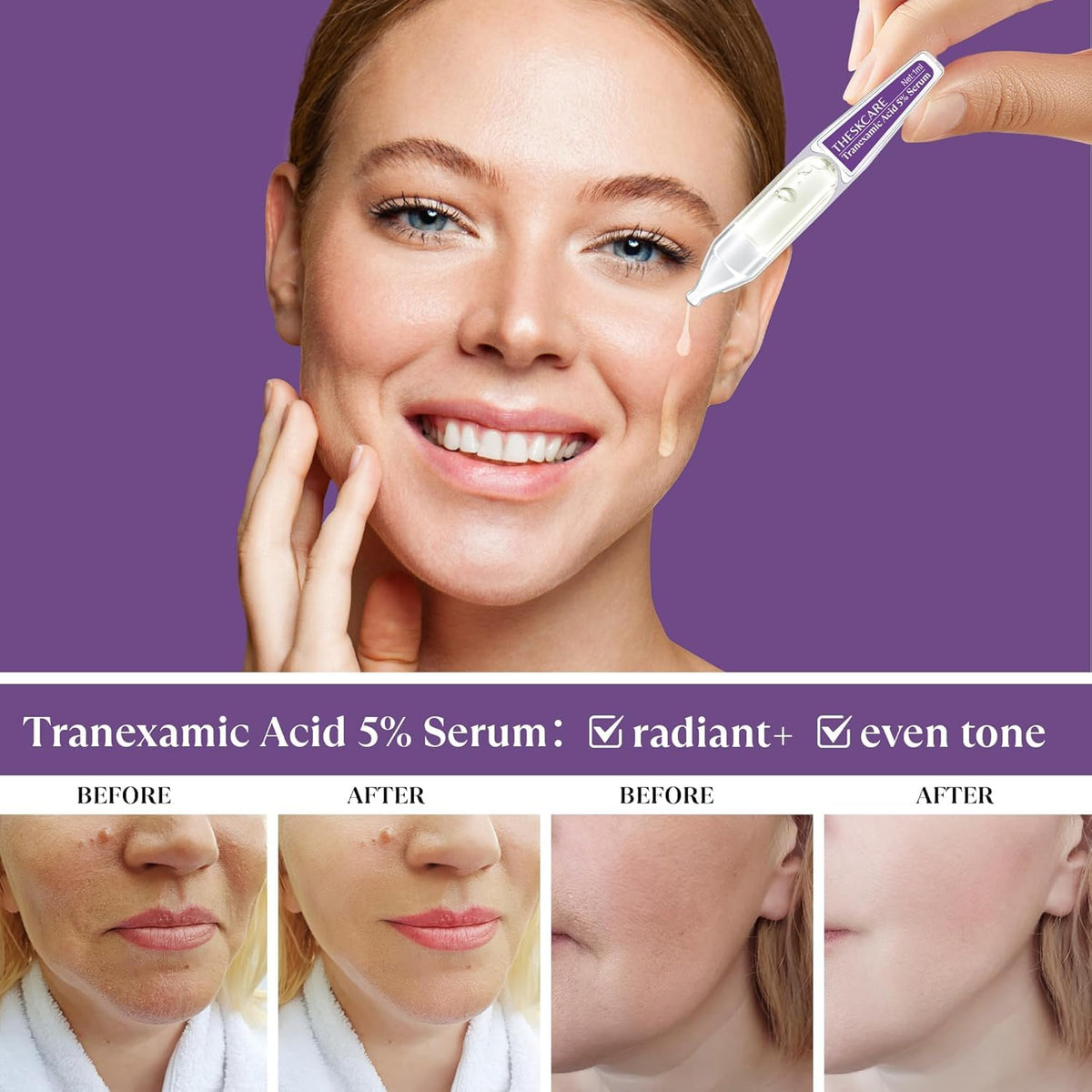 THESKCARE single ampoule opened for precise hygienic application
