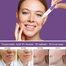 THESKCARE single ampoule opened for precise hygienic application