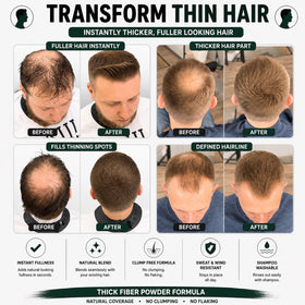 Thick Fiber after application on scalp hiding sparse area naturally