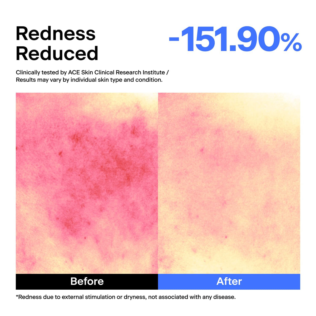 THOME before and after texture illustration showing smoother, balanced-looking skin